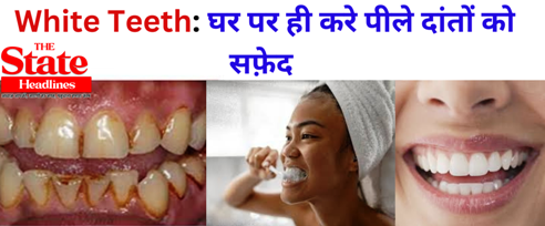 White Teeth