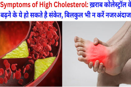 Symptoms of High Cholesterol